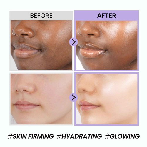 coxir BLACK SNAIL COLLAGEN CREAM l Snail Mucin, Collagen, Black Rice, Peptide l Moisturizing, Firming, Skin Barrier l Korean Skin Care, Moisturizer [50ml/1.69 fl.oz]