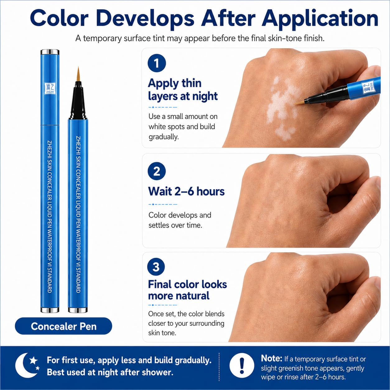 ZHEZHI Vitiligo Concealer Pen – Waterproof Face & Body Coverage for White Spots & Uneven Skin Tone, Long-Lasting & Sweatproof, Light to Medium Skin, 3.5g