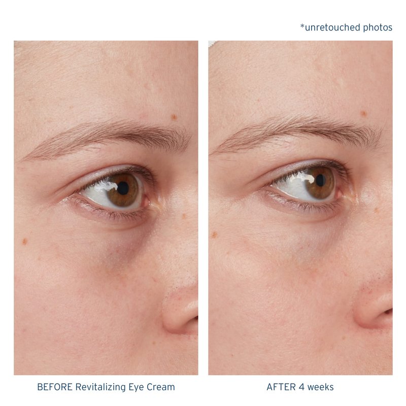 Santo Remedio, Piel Eterna, Revitalizing Eye Cream, Illuminating Eye Cream, Helps Reduce Dark Circles, Contains Marina Algae, Caffeine, Aloe, Hyaluronic Acid, Vitamin E, For All Skin Types, 1 Fl. Oz.