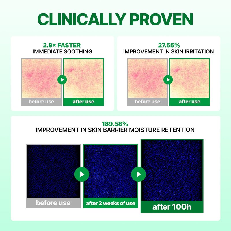 MAKE P:REM INTECA™ Soothing Cream | 2.9x Faster Trouble Relief with Advanced Non-Comedogenic Centella Asiatica for Acne-Prone Sensitive Skin, All Skin Types, Korean Vegan Moisturizer, 2.70 fl. oz.