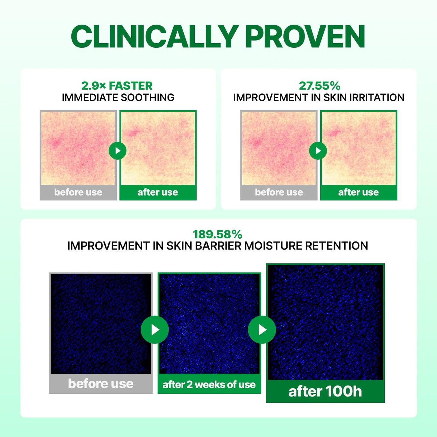 MAKE P:REM INTECA™ Soothing Cream | 2.9x Faster Trouble Relief with Advanced Non-Comedogenic Centella Asiatica for Acne-Prone Sensitive Skin, All Skin Types, Korean Vegan Moisturizer, 2.70 fl. oz.