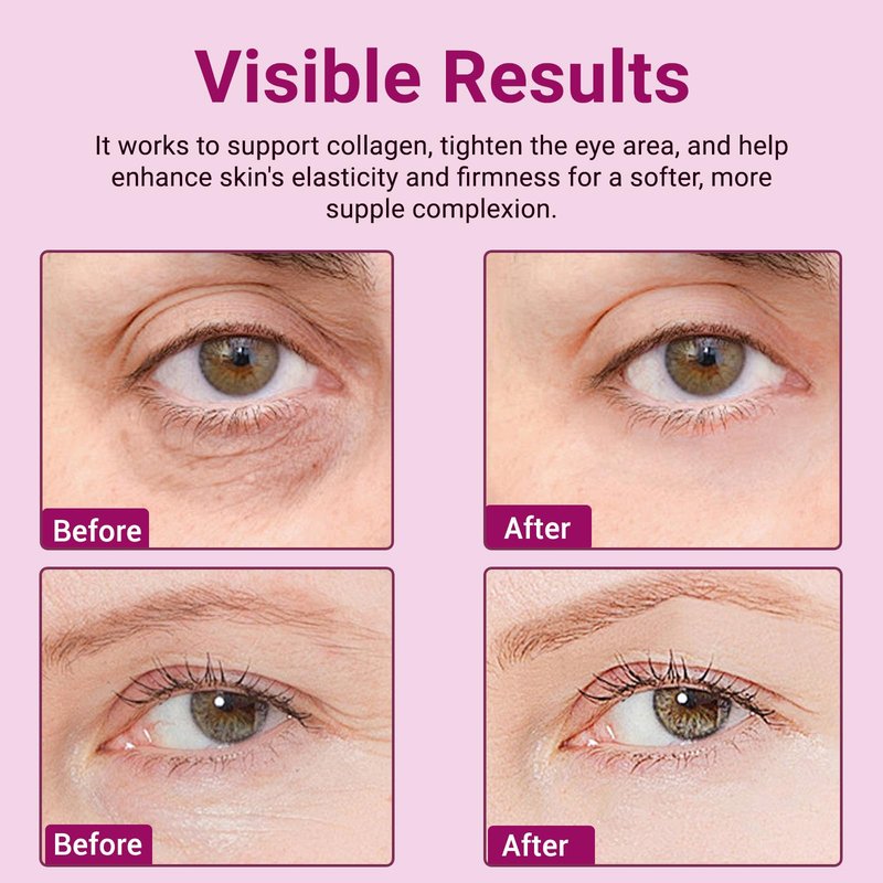 VCEVIP Calcium Volume Multi Balm Stick - Anti-Aging Collagen Cream for Intensive Hydration, Wrinkle Repair & Skin Firming, Suitable for Face, Eyes and Neck.