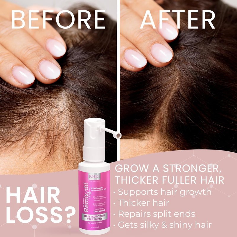 2% Minoxidil for Women Hair Regrowth Spray– Minoxidil Thicker & Fuller Topical Solution for Hair Loss Treatment, Follicle Reactivation - 60 ml (Pack of 2)