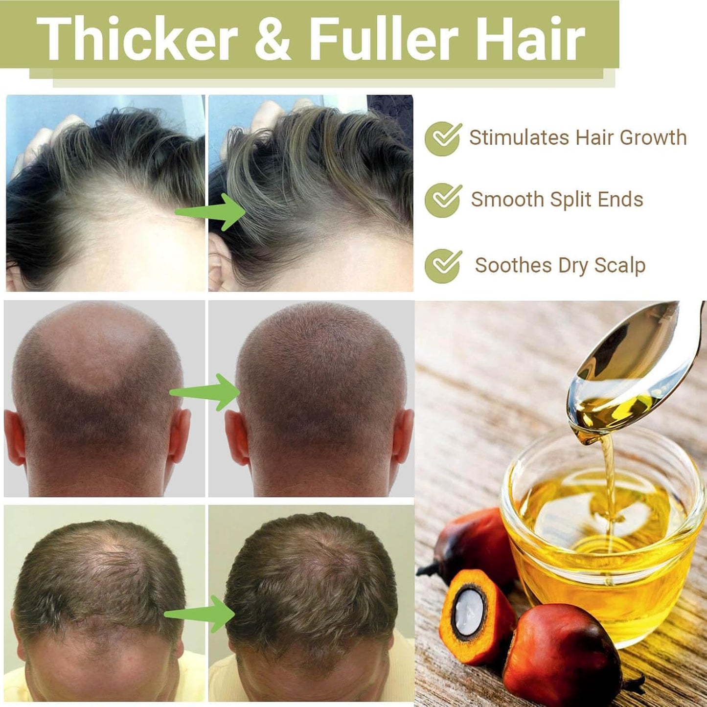 Lifewitqueenp Hair Care Growth Oil, Queenp Ayurvedic Hair Growth Oil, Lightweight for All Hair Types (1pcs)