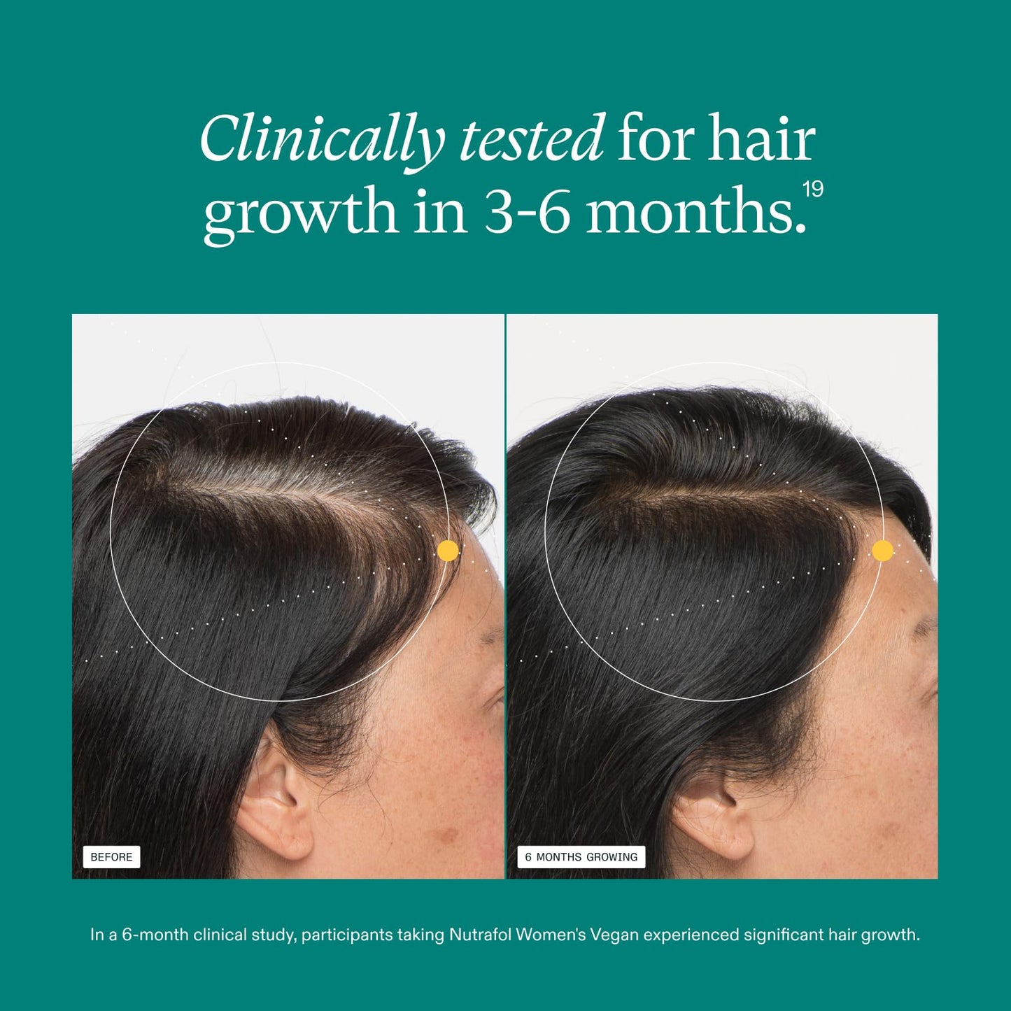 Nutrafol Women's Hair Growth Supplements, For Women 18-44 Years Old, Clinically Tested for Visibly Thicker, Stronger Hair, 100% Vegan Ingredients, Dermatologist Recommended - 3 Month Supply