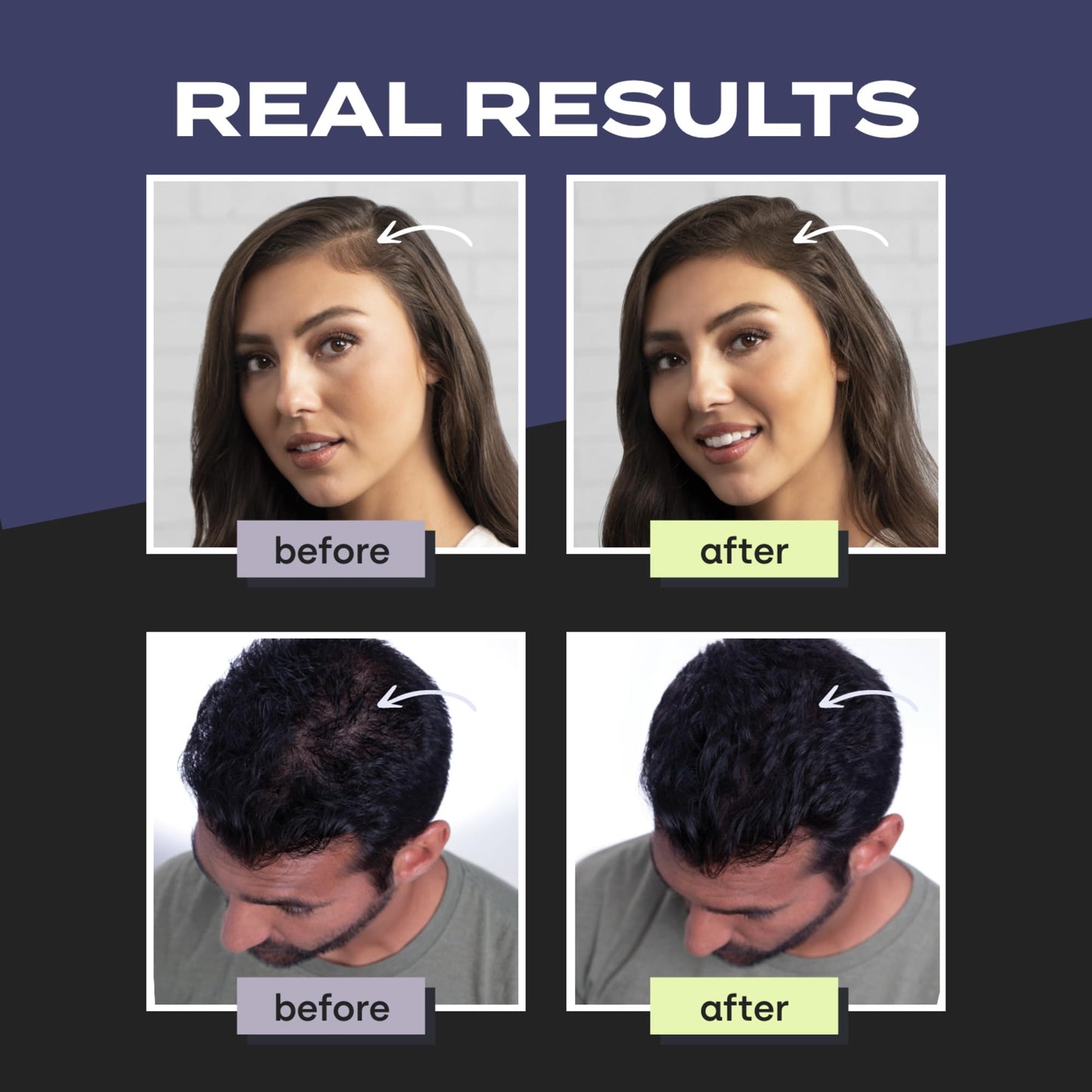 Toppik Hair Building Fibers, Medium Blonde, 3g Fill In Fine or Thinning Hair, Instantly Thicker, Fuller Looking, 9 Shades for Men & Women, Keratin Protein Formula
