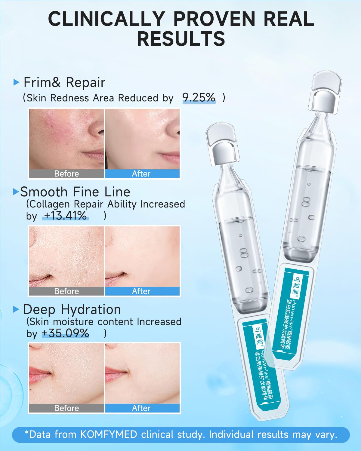 KOMFYMED Recombinant Collagen Restoration One-Day Serum – 4 Types of Collagen & Ectoin, Intensive Barrier Strengthening & Hydration, Single-Use Vials for All Skin Types (1.5ml / 0.05 fl.oz × 5)可复美胶原棒