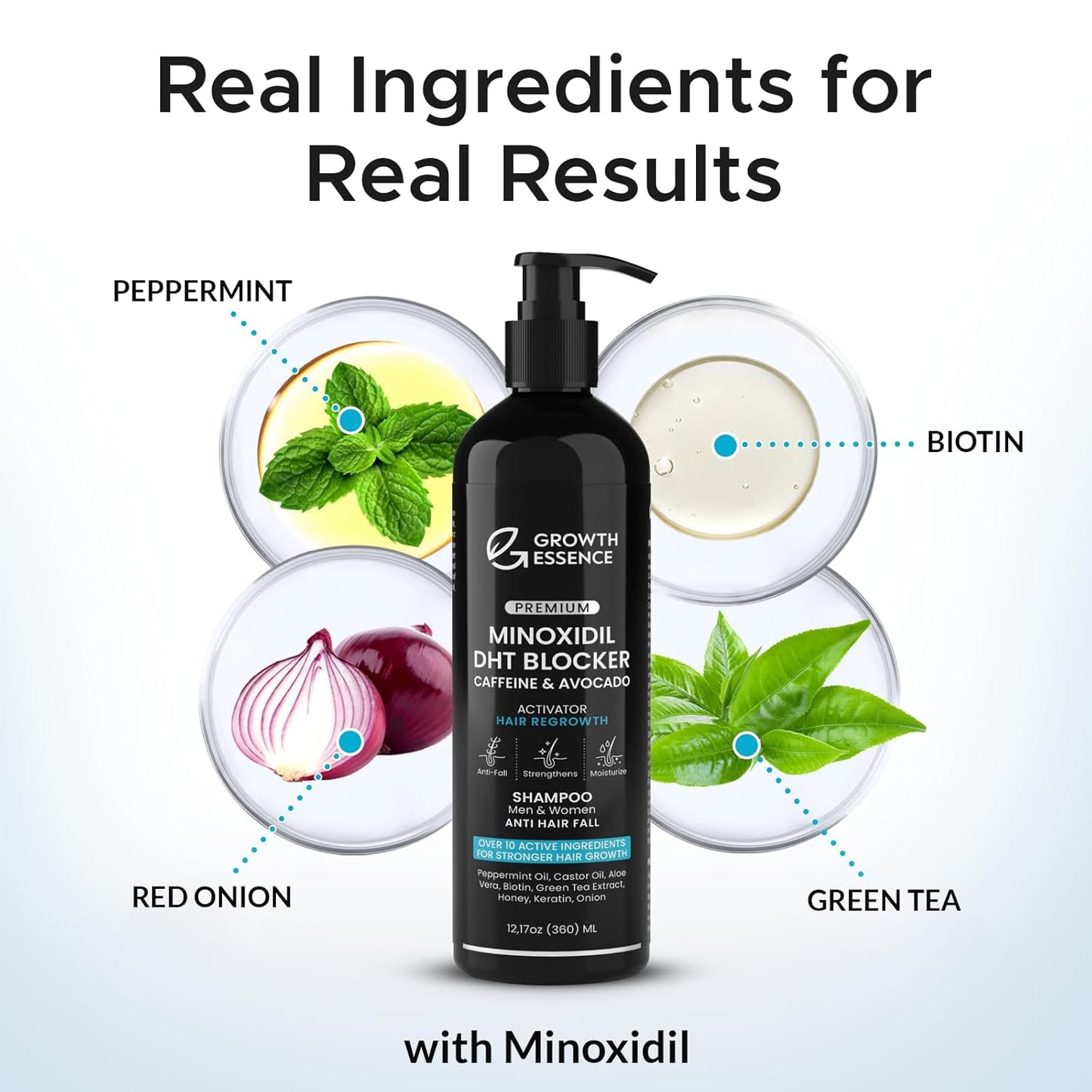 Minoxidil & Biotin Shampoo for Hair Growth - Caffeine, Castor Oil & Onion Infused | DHT Blocker for Thicker, Healthier Hair