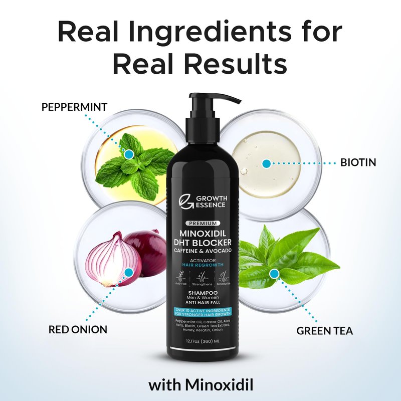 Minoxidil & Biotin Shampoo for Hair Growth - Enriched with Caffeine, Castor Oil & Onion - DHT Blocker for Thicker, Healthier Hair - Strengthening Formula for Men & Women