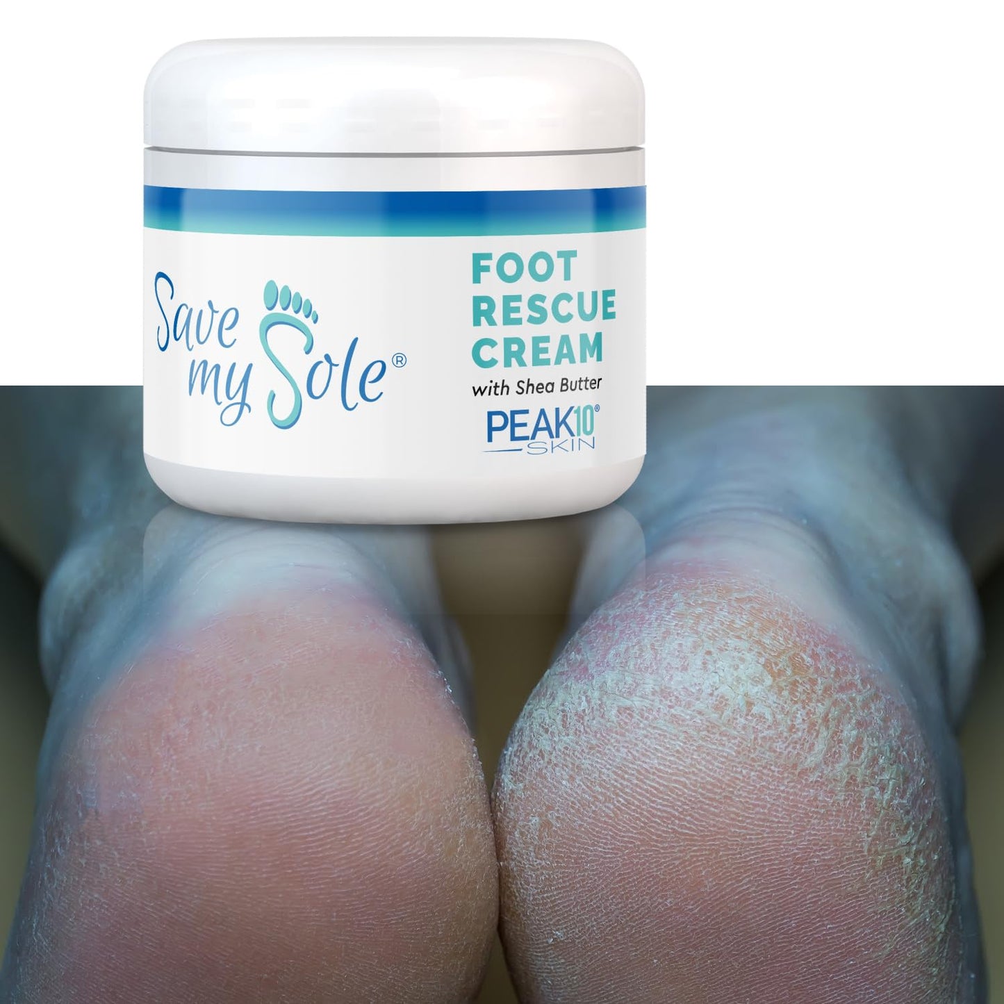 PEAK 10 SKIN - SAVE MY SOLE foot rescue cream 4oz