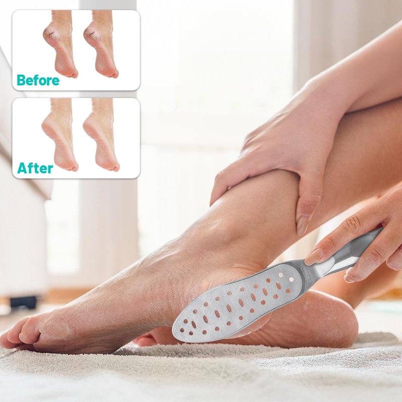 Foot File Callus Remover Stainless Steel Double Sided Foot Scraper, Foot Rasp for Dry and Wet Skin, Pedicure Tool for Feet Hard Skin and Cracked Heels