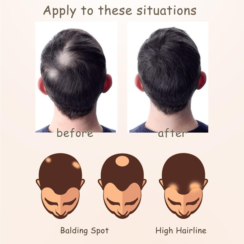 viviaBella human hair hairloss on temples bald spot toupee scar human hair replacement hairline straight Tape-on Triangle hair patch for men and women（2Pcs） (Dark Brown, about 1"*1"*1")