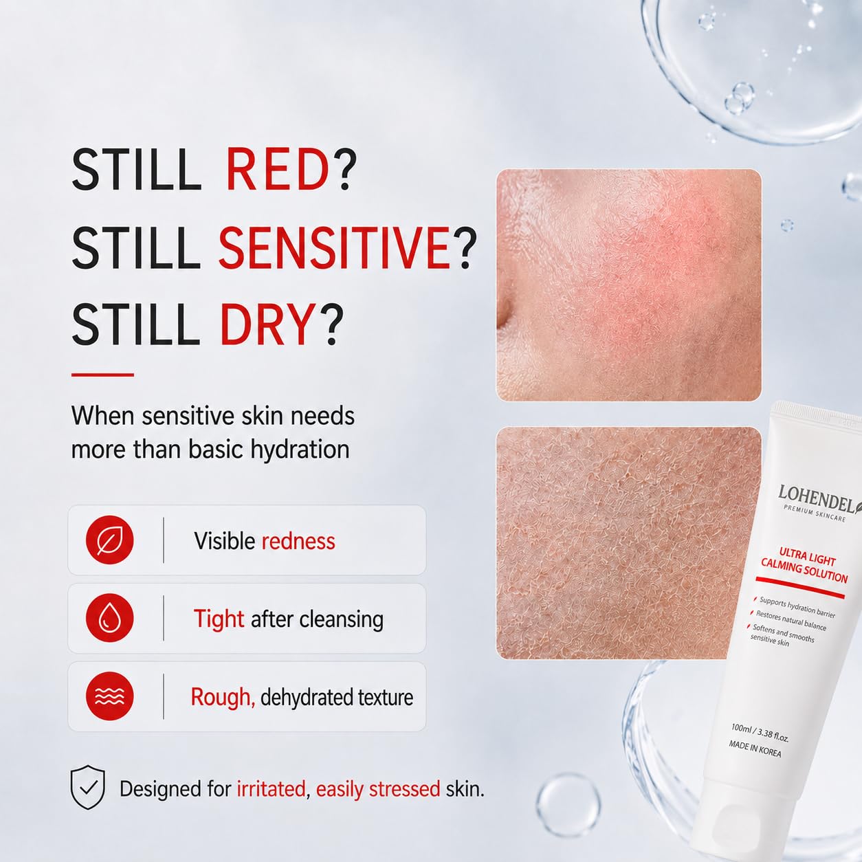 LOHENDEL Ultra Light Calming Solution - Soothe Redness, Repair Barrier