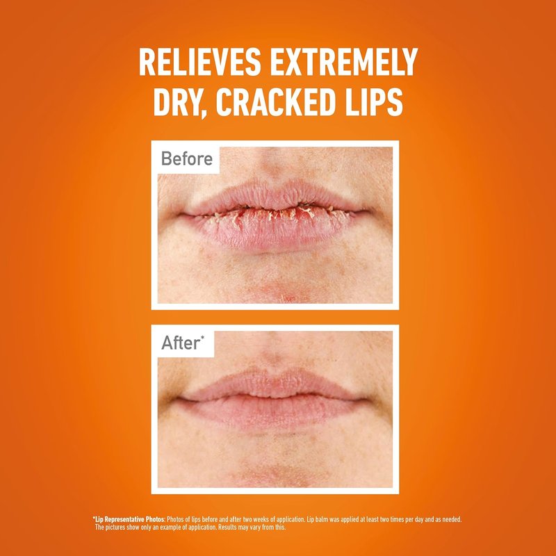 O'Keeffe's Lip Repair & Protect Balm SPF 15 - Moisturizing Lip Care 4.2g