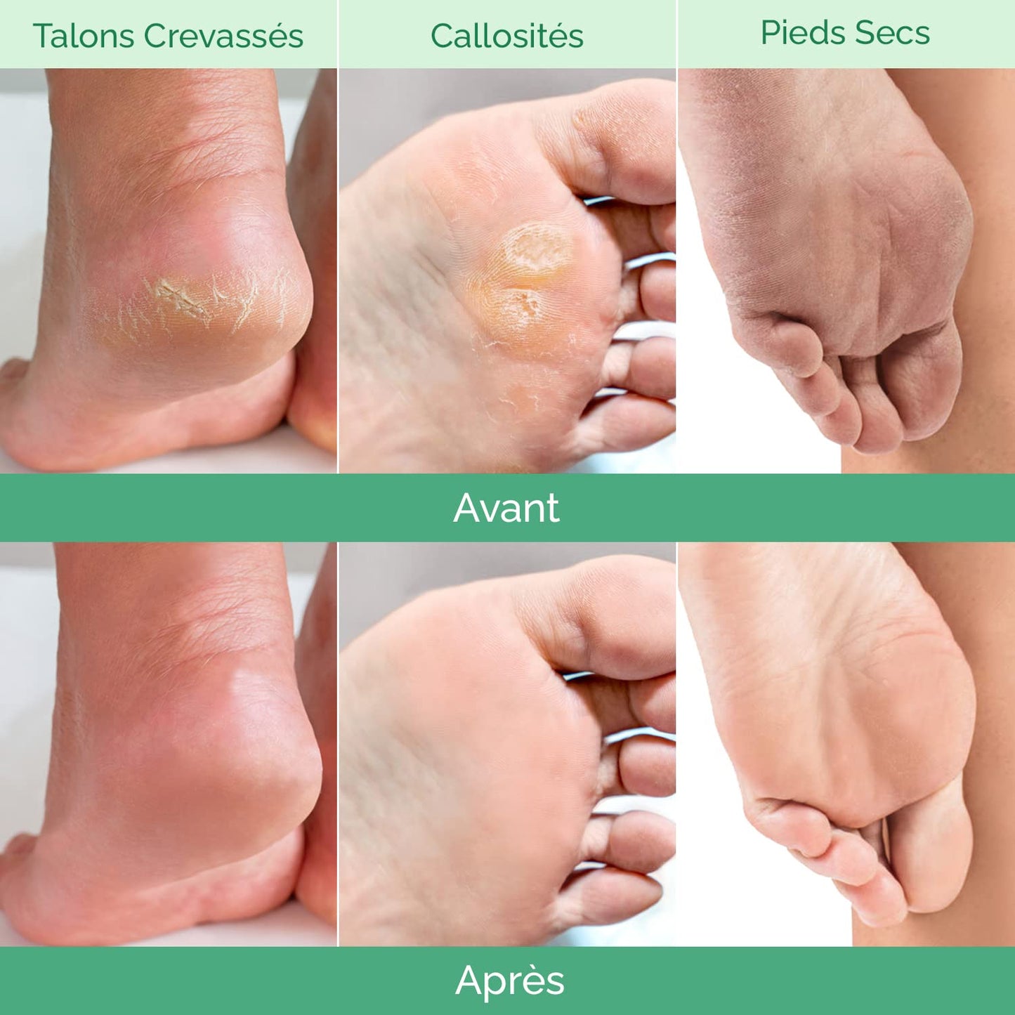 Plantifique Foot Peeling Mask - Exfoliating Clay Mask for Baby Soft Feet | 2 Pack, 110g