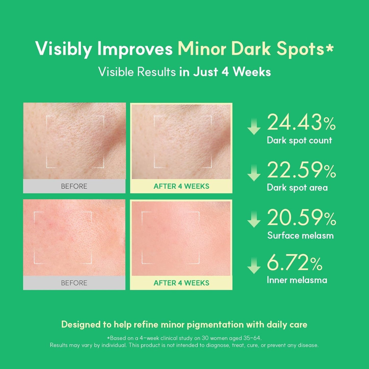 Easydew DW-EGF Melatoning Ampoule 1X - Hydrating Dark Spot Serum with Niacinamide & Glutathione for Uneven Skin - Fast Absorbing Day & Night Ampoule Korean Skin Care (Bottle 1.01 fl oz, EGF 1X)