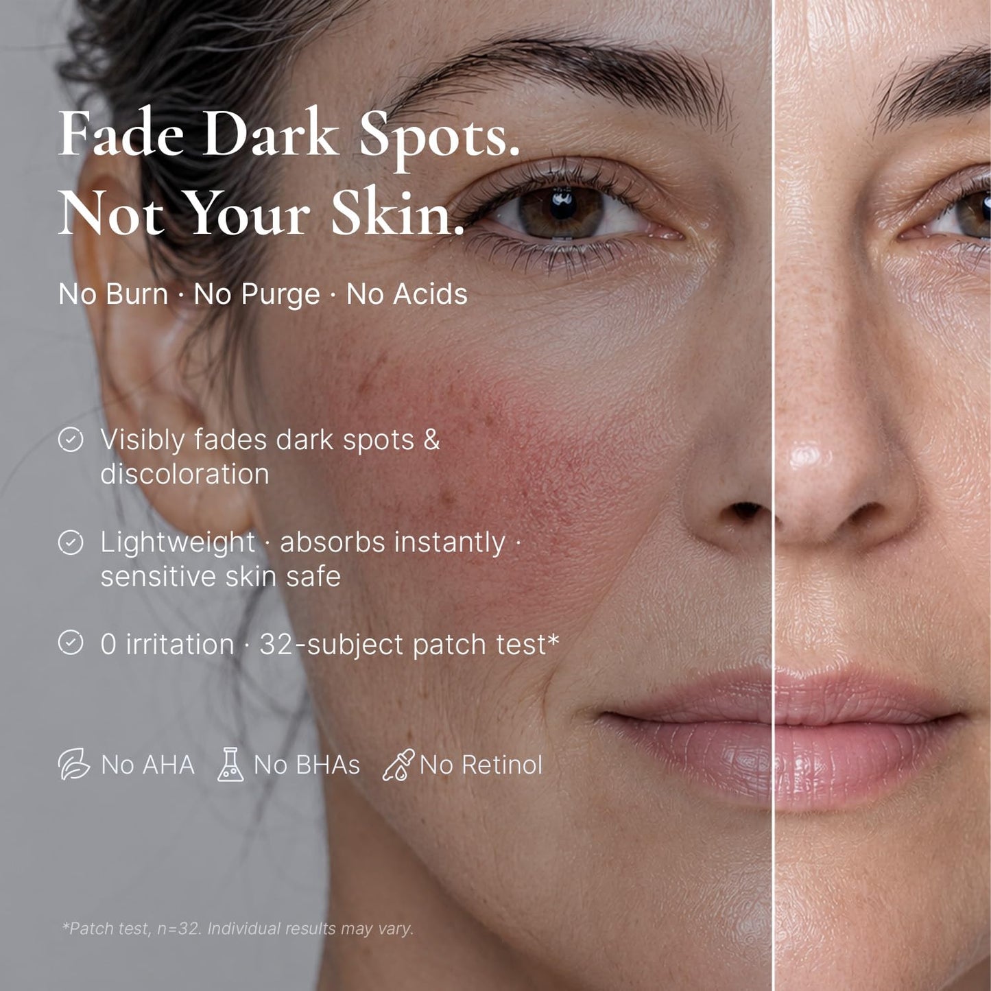EnaSkin Dark Spot Corrector for Face & Body - 5% Tranexamic Acid, Niacinamide & Acid-Free Renewal Peptide - Hyperpigmentation, Melasma & Sun Spot Treatment, Gentle for Sensitive Skin, 1.01 fl oz