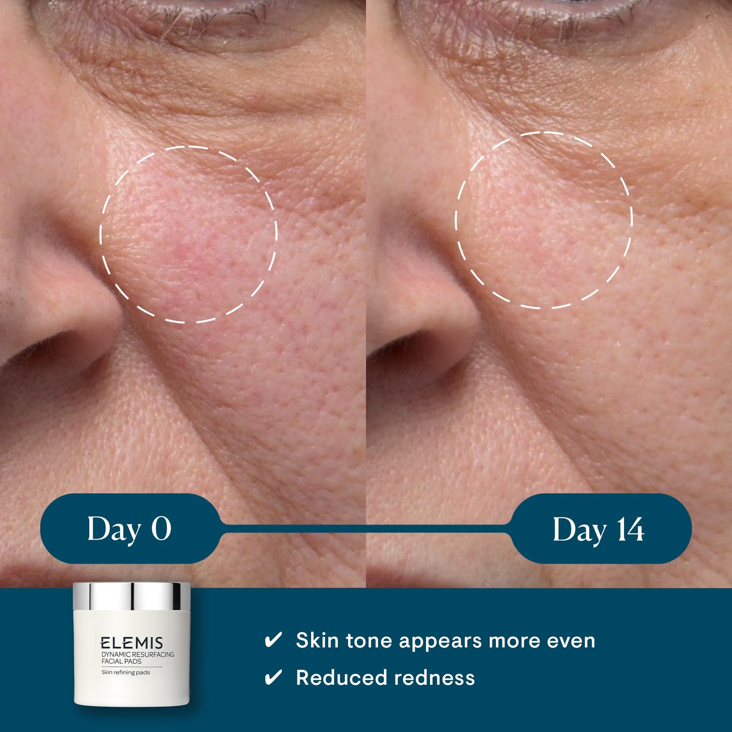 ELEMIS Dynamic Resurfacing Facial Wash and Dynamic Resurfacing Pads