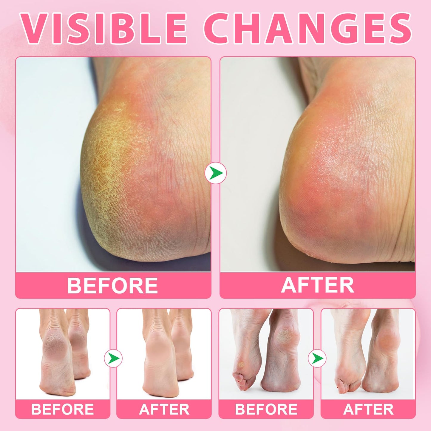 Urea Cream 60% Plus Salicylic Acid 2% Intensive Foot Repair Balm Stick for Dry Cracked/Chapped Heel/Hands Intensively Moisturization, Callus Removal/Softening/Soothing-Peach Scent|1.41 Oz/40 G
