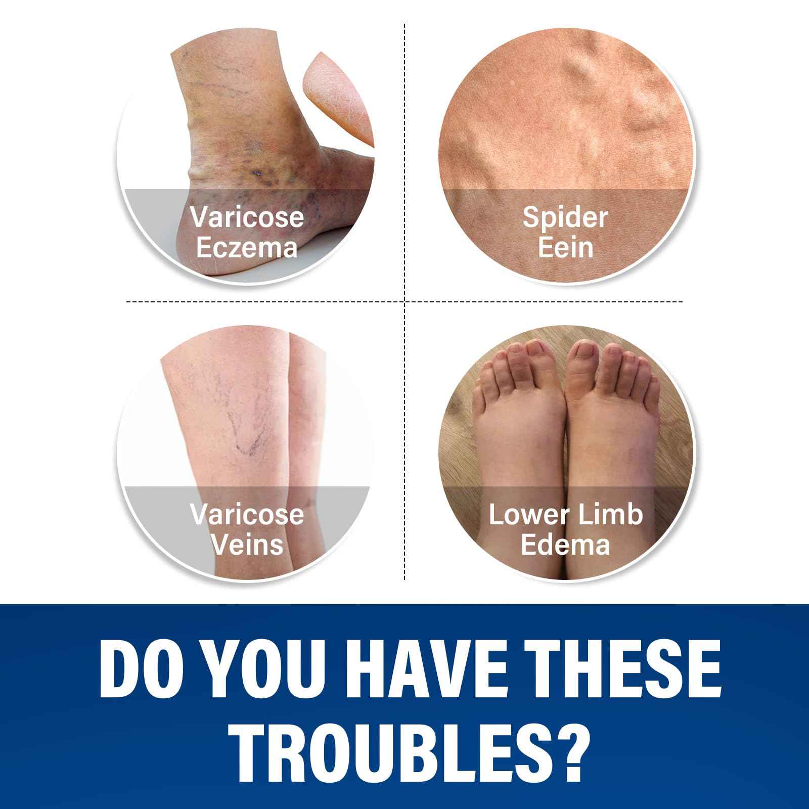 Josera Varicose Veins Treatment for Legs, 2 Count Varicose Veins Cream - Improves Blood Circulation and Reduces Heaviness