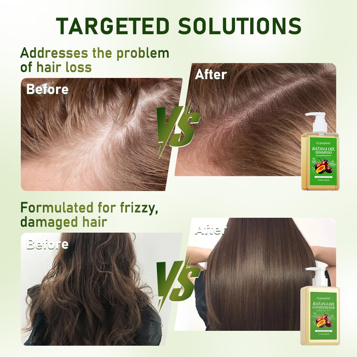 Gypsophila Batana Oil Shampoo and Conditioner, Hair loss and Batana Oil for Hair Growth Shampoo, Sulfate-Free for Both Men and Women 10.14 Fl Oz