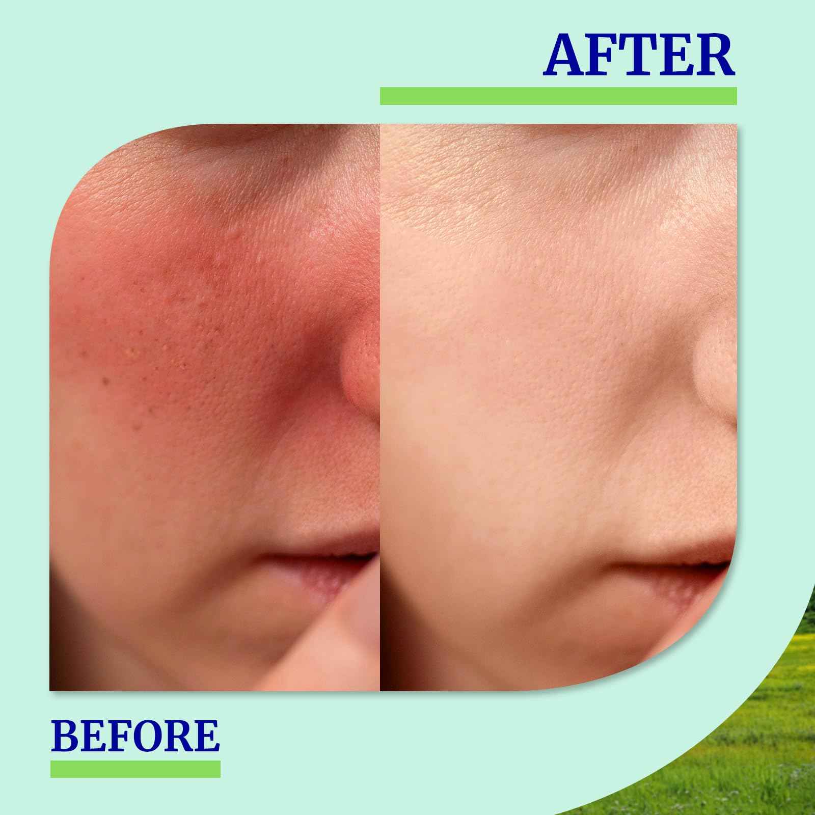 larosanna Soothing Moisturizing Lotion for Sensitive Skin Made in Australia,Skin Care Ideal for Redness and Dryness Relief,Face Moisturizer for Women with Gentian Root Extract,3.55 fl oz