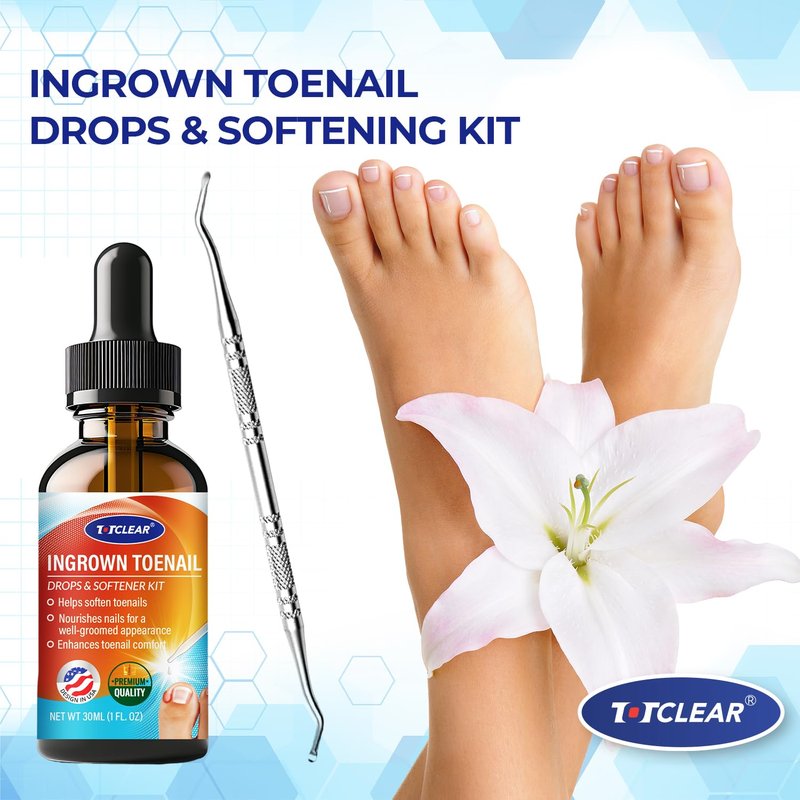 Ingrown Toenail Relief Tool - Effective Ingrown Toenail Removal Kit for Men & Women | 30ml