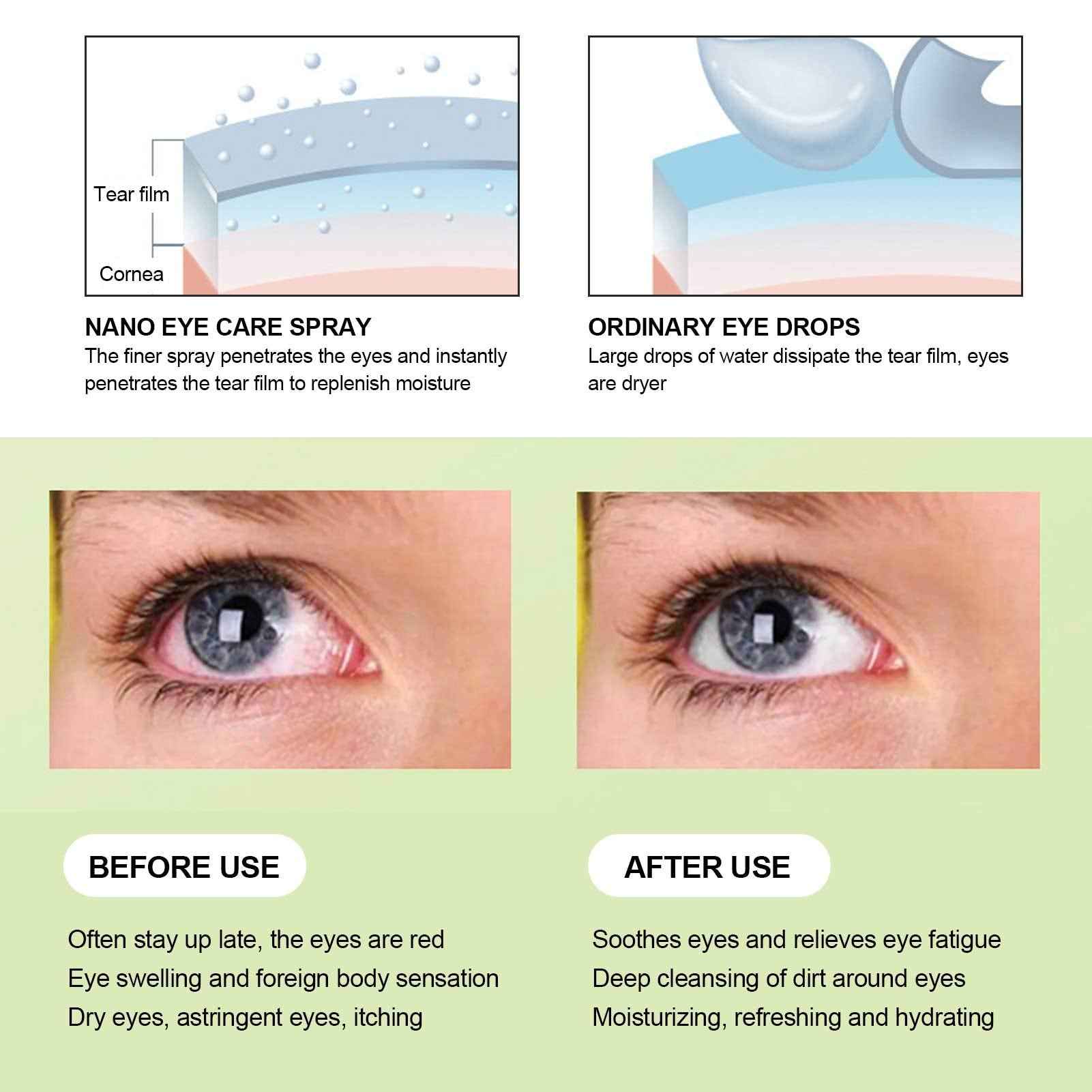 Eye Sprayer, Mini USB Charging Handheld Eye Care Spray Professional Mist Portable Eye Moisturizing Cleaning Soothing Machine Eye Cleaner Eyelid Cleanser Tool for Adult &