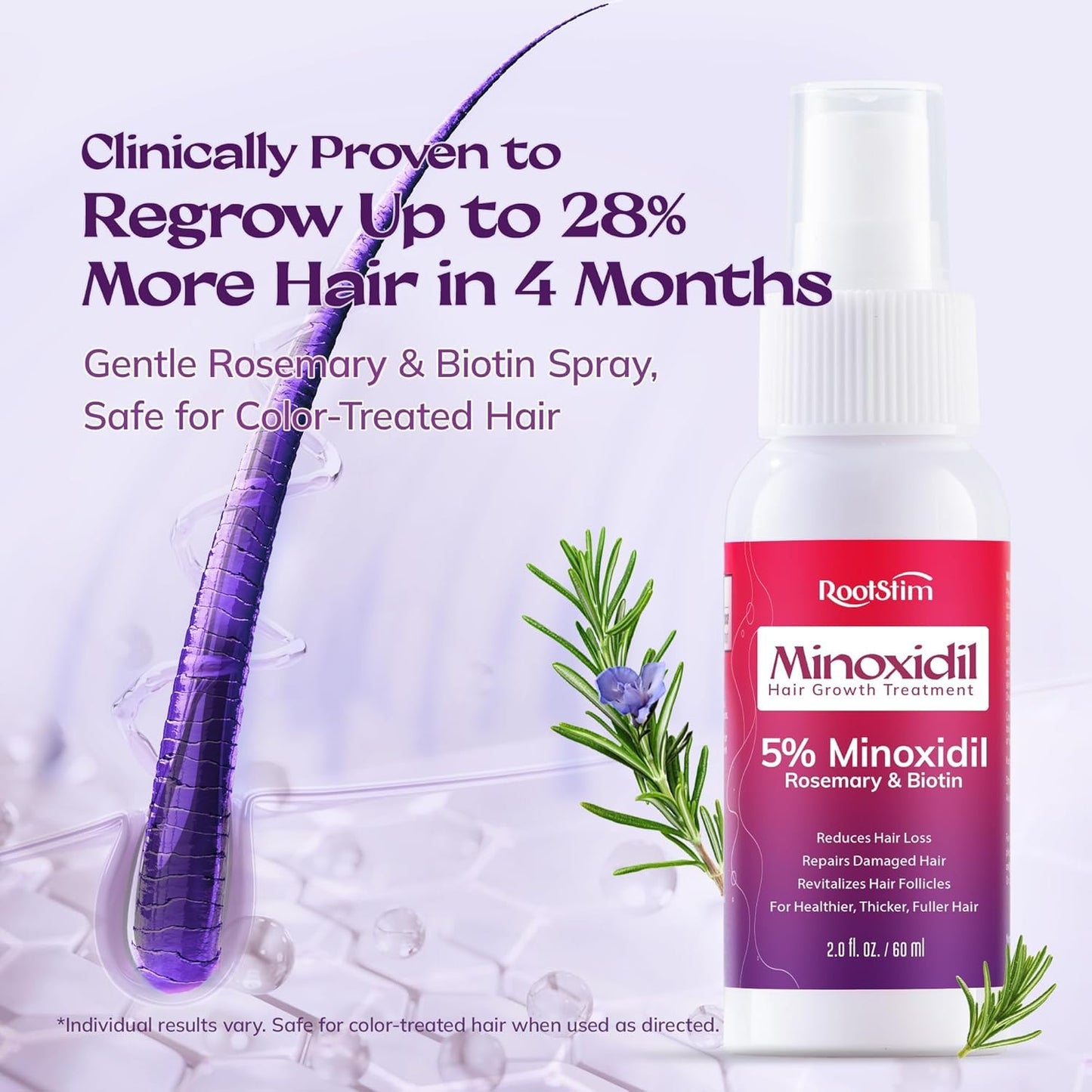 Women's 5% Minoxidil Spray for Hair Growth: RootStim Extra Strength Minoxidil with Rosemary & Biotin for Thinning Hair Regrowth and Fuller Hair - 0.09 Fl Oz