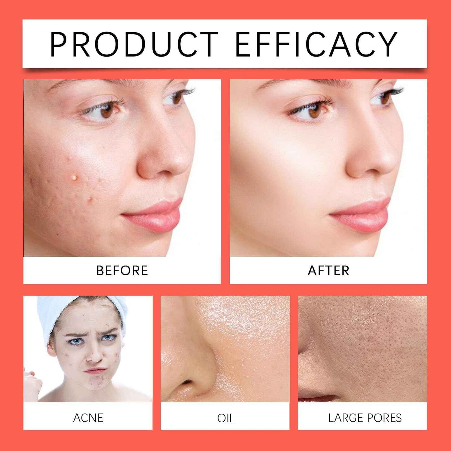 guluxly Lemon Turmeric Kojic Soap Bar – Natural Turmeric Handmade Soap with Lemon, Vitamin C for All Skin Types