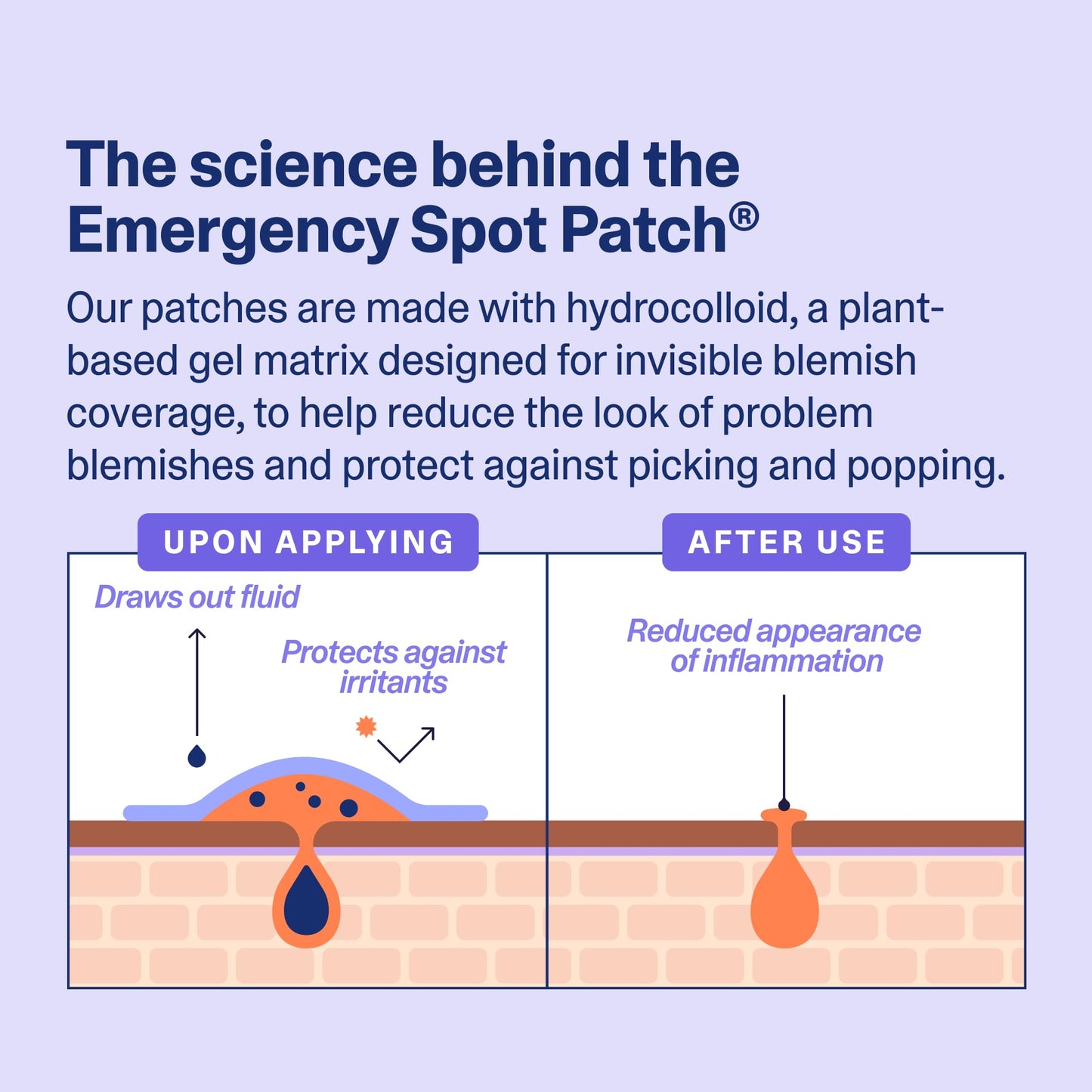 Curology Emergency Spot Pimple Patches for Face, Hydrocolloid Pimple Patches Fast-Acting, 160 Count
