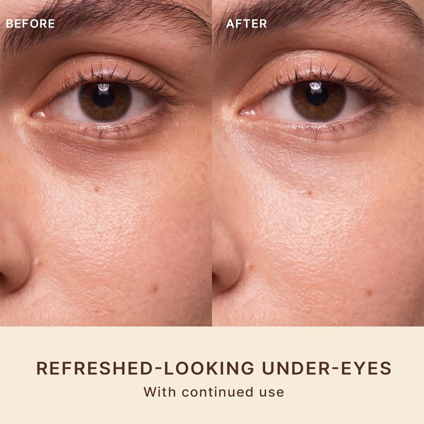 Beauty by Earth Caffeine Eye Cream for Puffiness & Bags Under Eyes - USA Made with Natural & Organic Ingredients, Under Eye Cream for Dark Circles with Glycerin & Vitamin E, Brightens & Refreshes