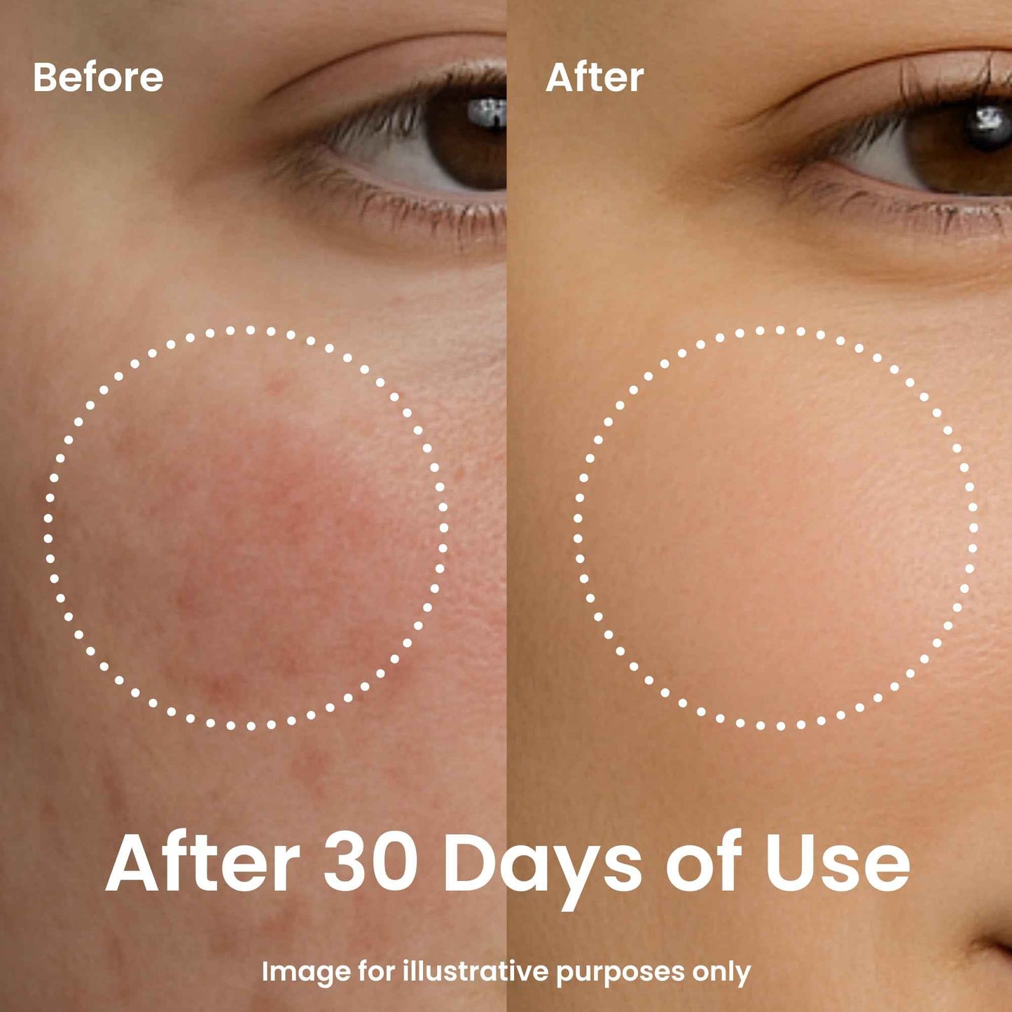 Feat By You ViTassie Pure Mountain Water First Care Toner - (5.41 FL OZ) Hydrating Toner for Face with Vitamin C & Hyaluronic Acid, Korean Skin Care Pore Minimizer Facial Toner, Vegan, Made in Korea