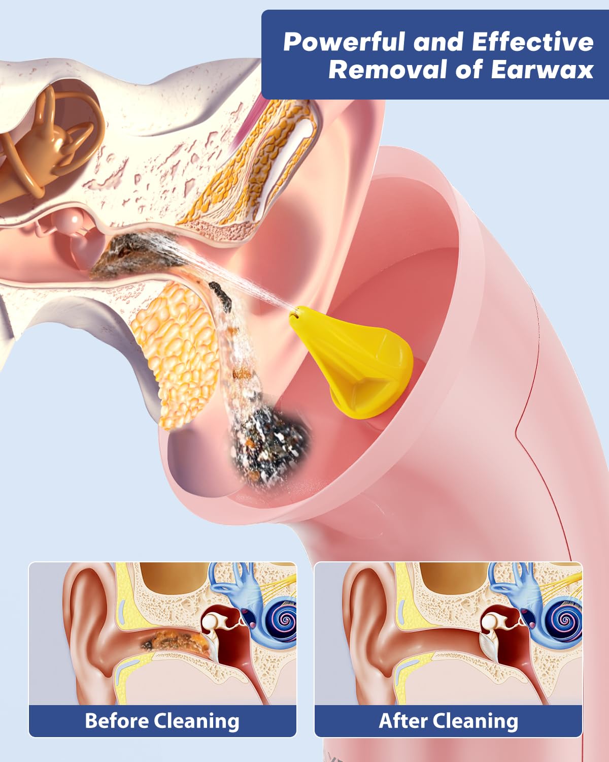 Upgraded Electric Ear Cleaner,Earwax Removal with 250ML Dual Water Tank Design,4 Water Pressures for Powerful Cleaning,8 Soft Earbuds,USB Charging,IPX7 for Safe and Effective Earwax Flushing