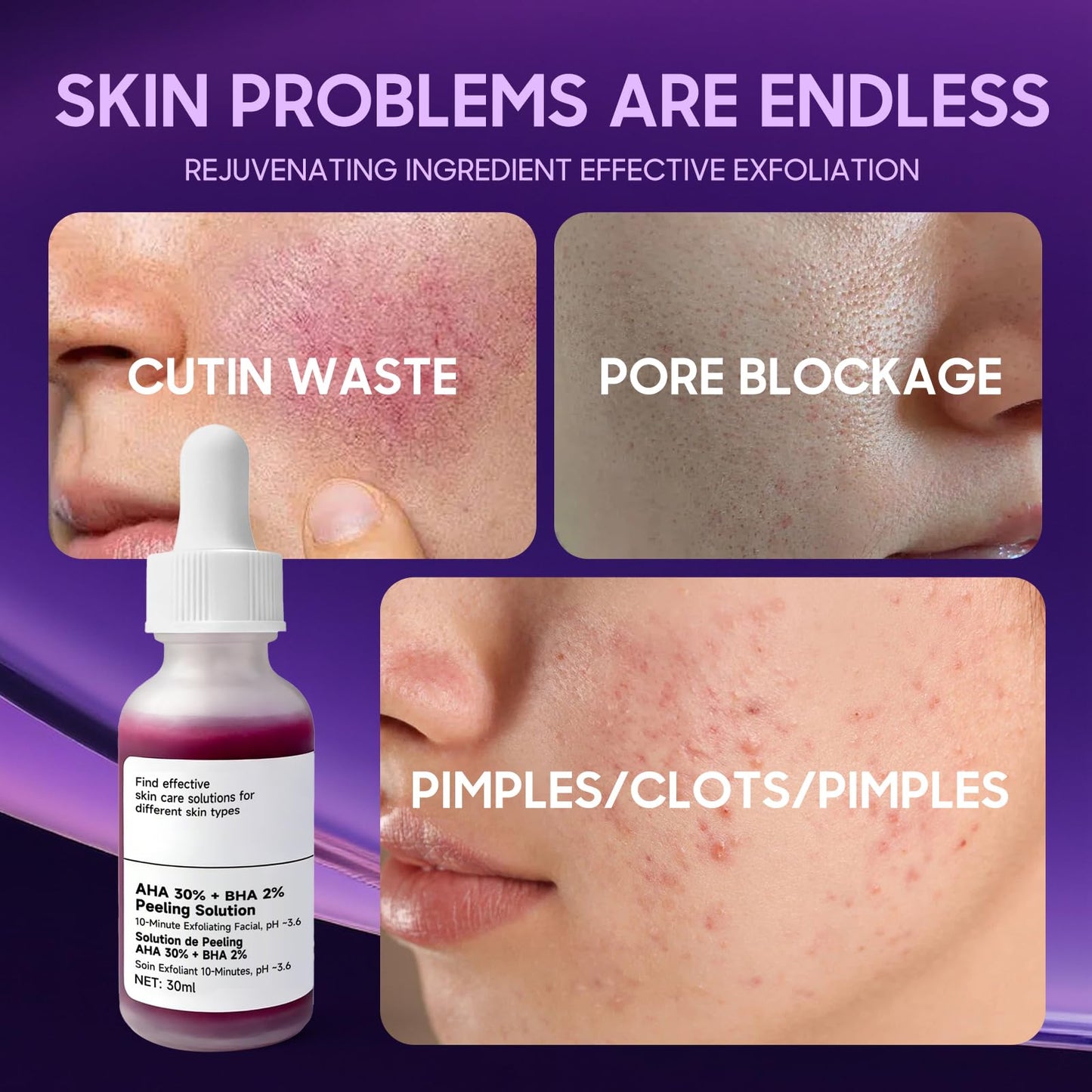 AHA 30% + BHA 2% Exfoliating Serum, Unclogs Pores, Brightens & Oil Control
