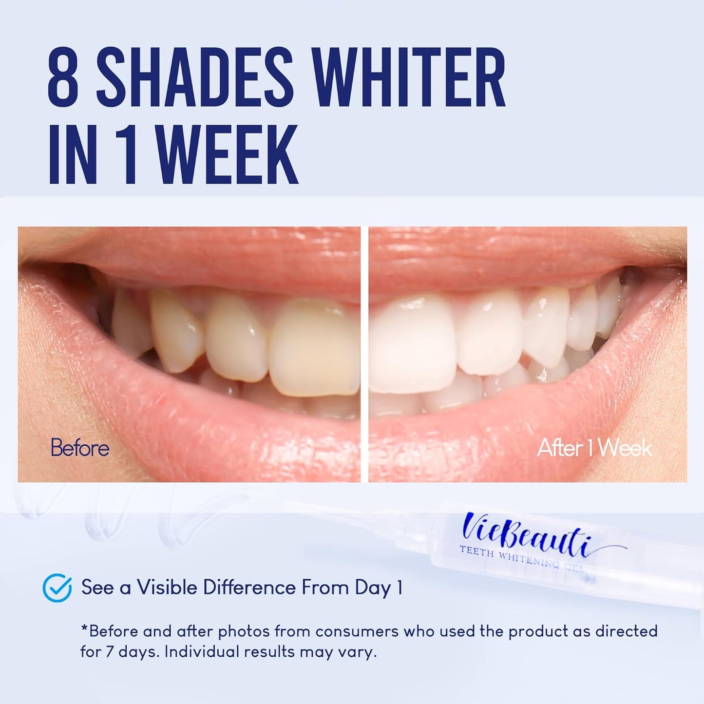 Teeth Whitening Kit - LED Light for Sensitive Teeth | 35% Carbamide Peroxide & Remineralizing Gel - Cool Mint Flavor