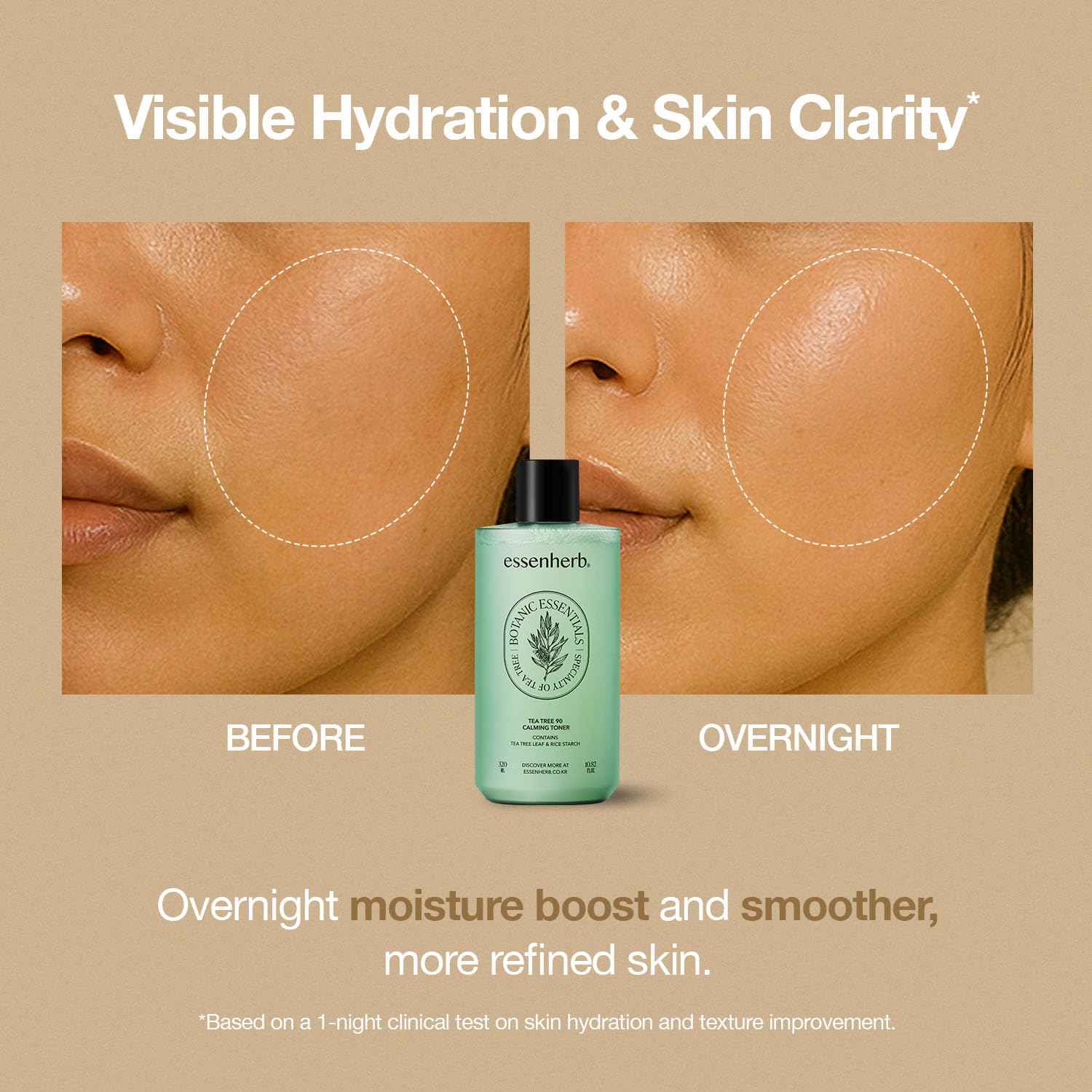 ESSENHERB Tea Tree 90 Calming Toner | Vegan | Real Tea Tree | Sebum Control | Mild Formula, Korean Skincare (320ml, 10.82oz)