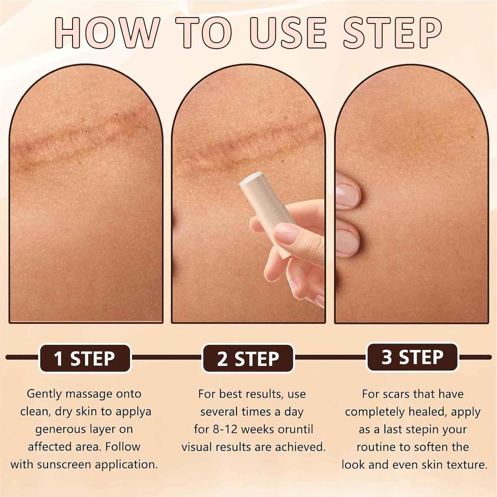 Silicone Scar Stick (2-Pack) - Helps Improve the Appearance of Old & New Scars on Face & Body, For Use After C-Section, Surgery, Acne, Burns - Non-Greasy, Easy-to-Use