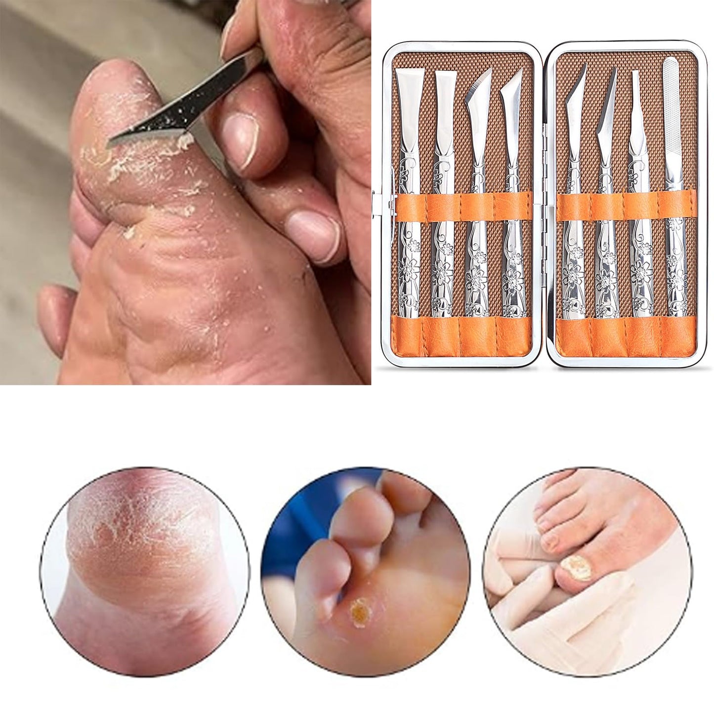 Exfoliating Ingrown Toenail Removal Pedicure Knife,Decorative Foot Knives for Ingrown Callus Shaver Feet Nail Correction Pliers Scissors Corn Remover With Storage Bag (3)