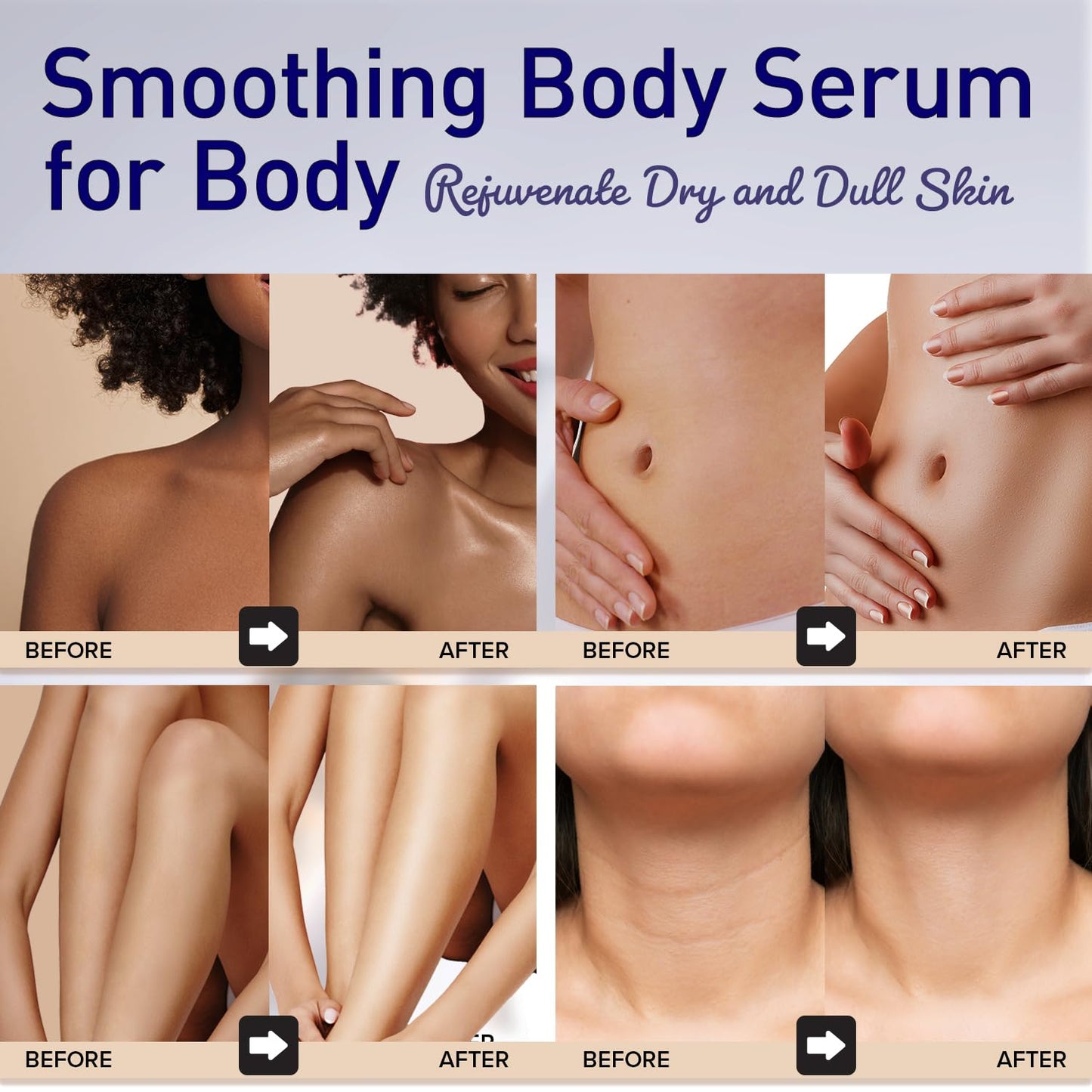 Enaskin Naturals Smoothing Body Serum Lotion for Dry and Crepe Skin: Anti-Wrinkle, Hydrating, Firming with Hyaluronic Acid & Niacinamide, Non-Greasy, for All Skin Type