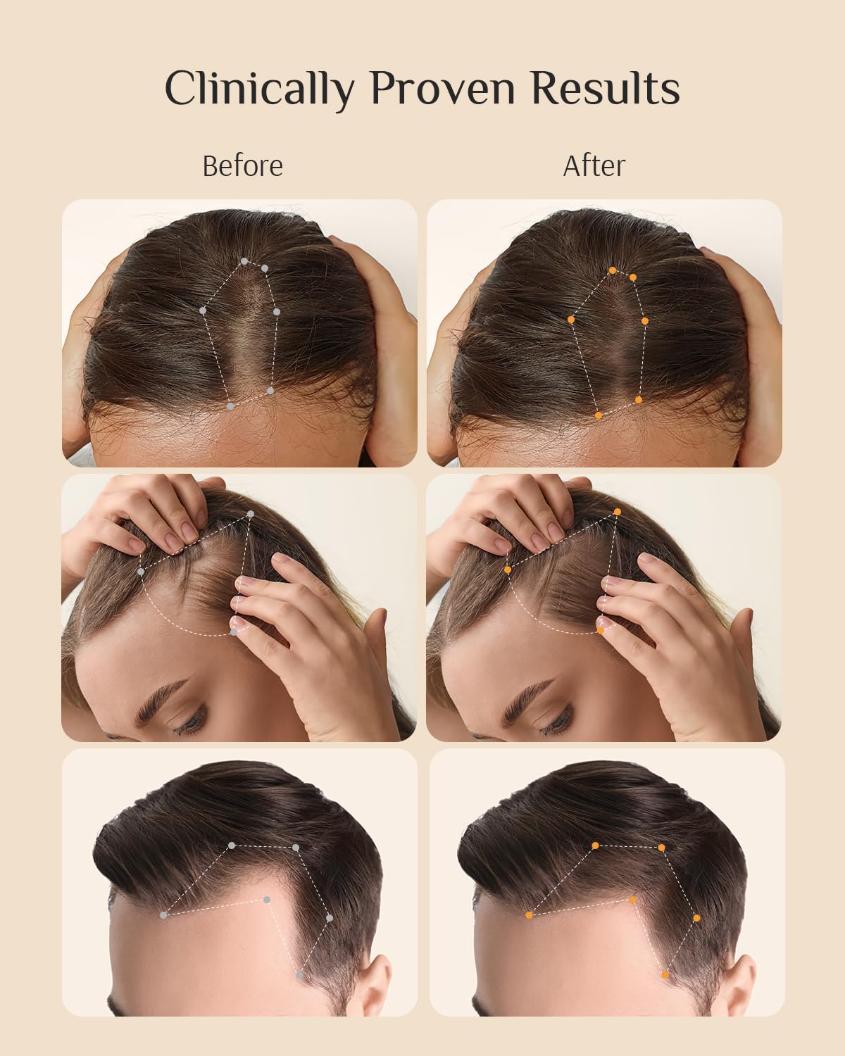 DR ZERO REDENICAL Hair Growth Shampoo for Women | MONDE SELECTION Gold Winner | Swiss Patent Redensyl | Clinically Proven Anti-Thinning | Japanese-Made Volumizing & Repair Shampoo, Gifts for Women