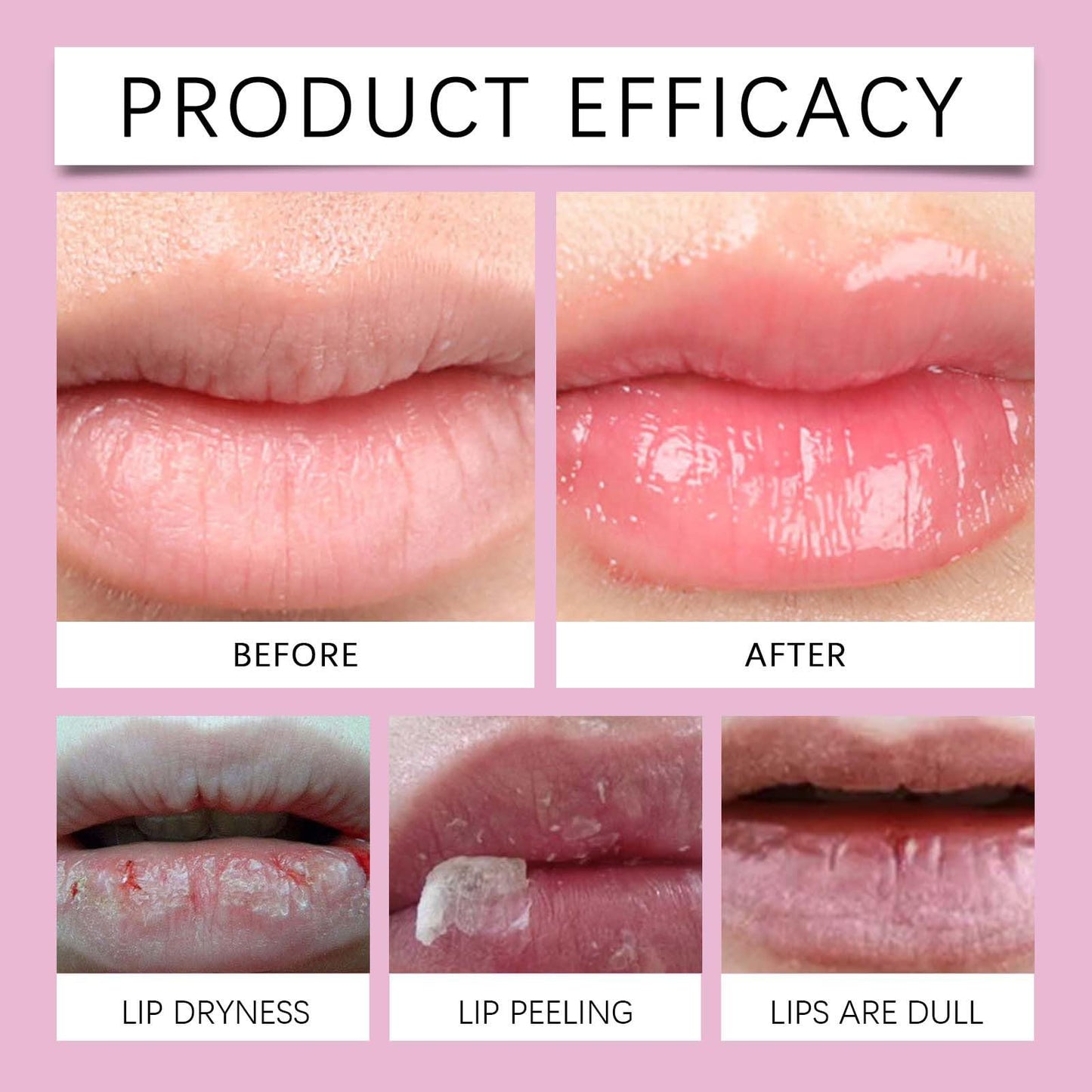 TUOSHITONG Pink Lip Serum for Dry and Dark Lips, Lip Lightener for Smokers and Non-Smokers, Conditioning LipSerum Moisturizer Help Fade Lips Discoloration with Alpha Arbutin & Aloe Vera 2PCS