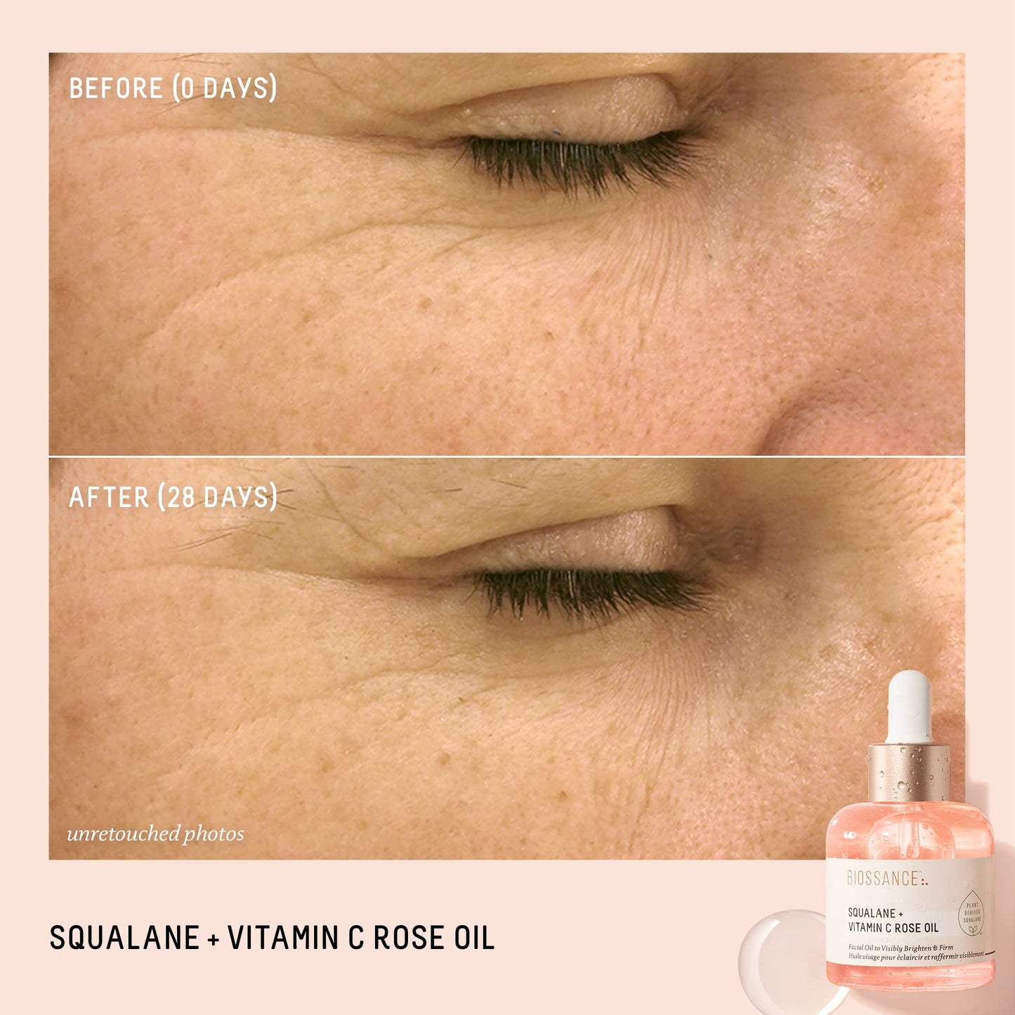 BIOSSANCE Squalane + Vitamin C Rose Advanced Facial Oil - Brightening, Firming, and Hydrating Serum for All Skin Types - Chios Crystal Oil, Damascus Rose Extract & Squalane for Radiance - 0.5oz