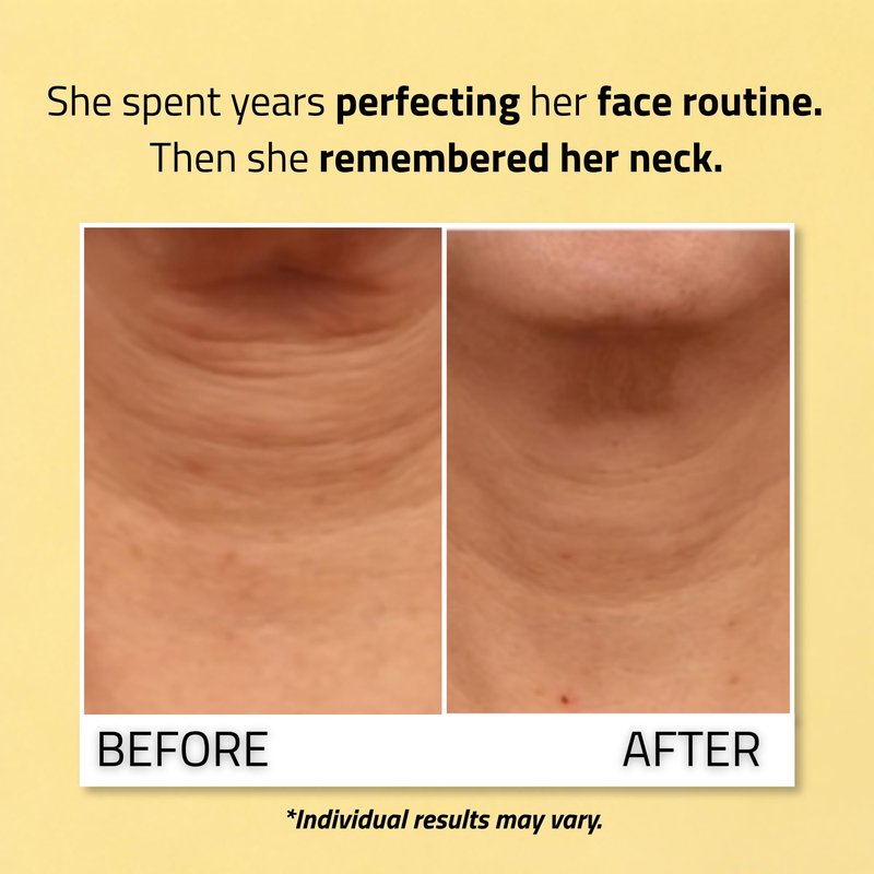 YEOUTH Neck Firming Cream with Vitamin C and Peptides, Neck Cream for Tightening and Firming Chest, Décolleté, Double Chin, Turkey and Crepey Skin, 4oz