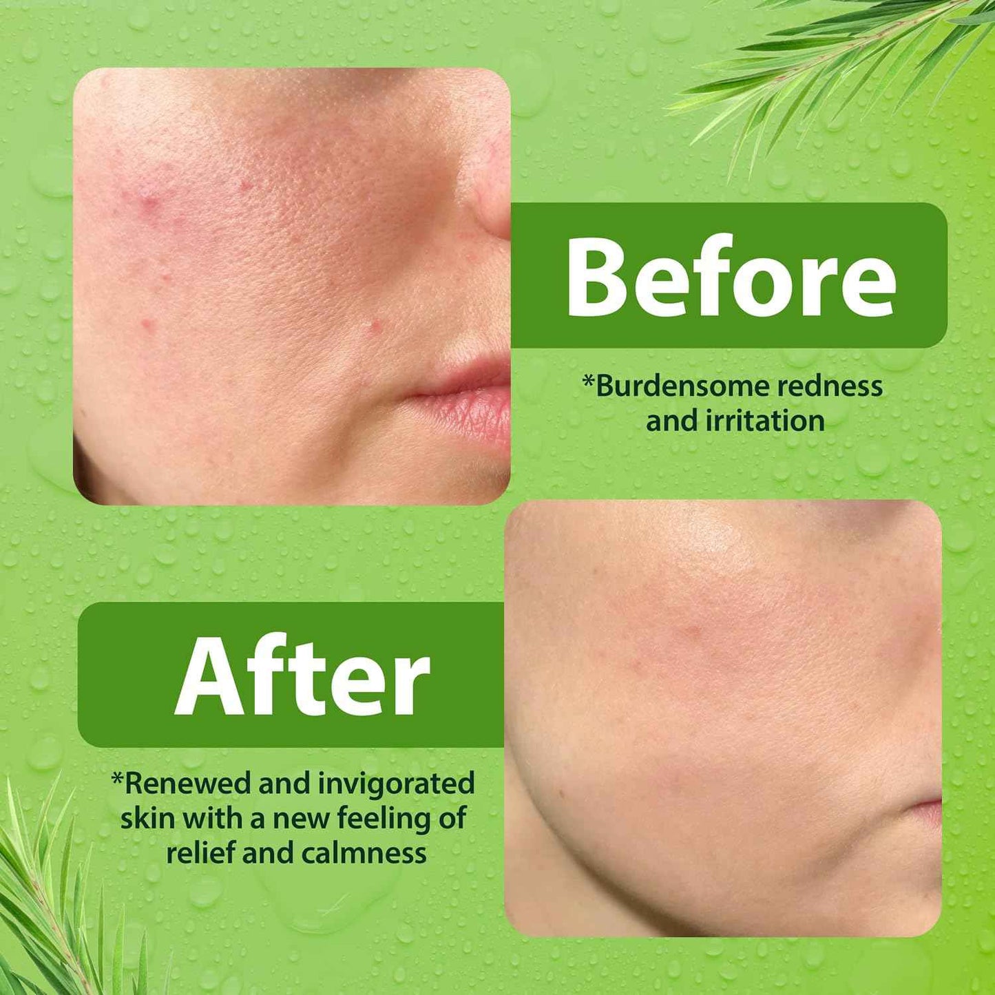 Gentle Face Wash for Men & Women – Hydrating Facial Cleanser for Eczema, Psoriasis & Sensitive Skin – Fights Redness, Oil & Breakouts – pH-Balanced & Perfect for Oily, Blemish-Prone Skin – 8oz