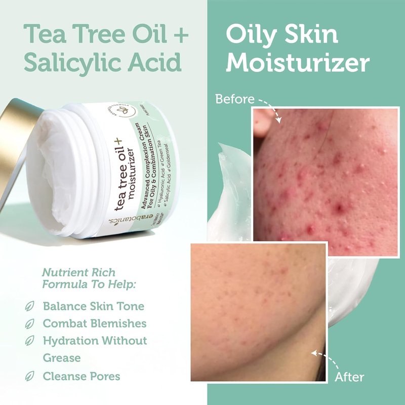 Tea Tree Moisturizer Cream - Advanced Oily Skin Acne Treatment | Non-Greasy Formula with Salicylic Acid & Green Tea