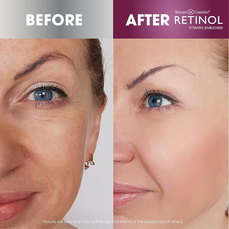Retinol Super Starter Kit - Vitamin A Powerhouse for Youthful Skin | Anti-Aging Essentials
