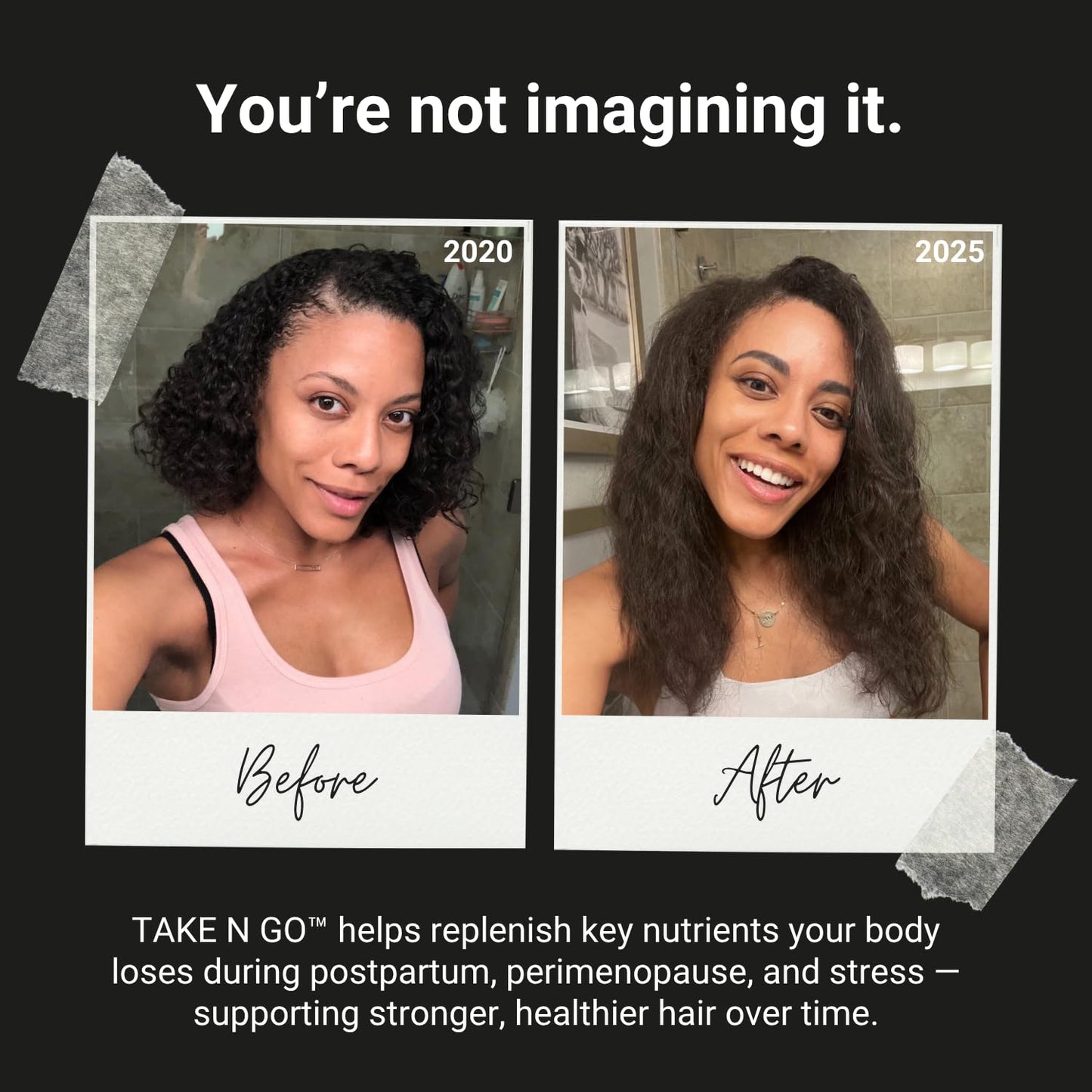 NU Standard Drink N GO Hair Hydrator for Dry Hair & Scalp - Tropical Electrolyte Powder Stops Shedding -Wild Caught Marine Collagen - BioPerine® - No Salty Aftertaste - 20 Servings