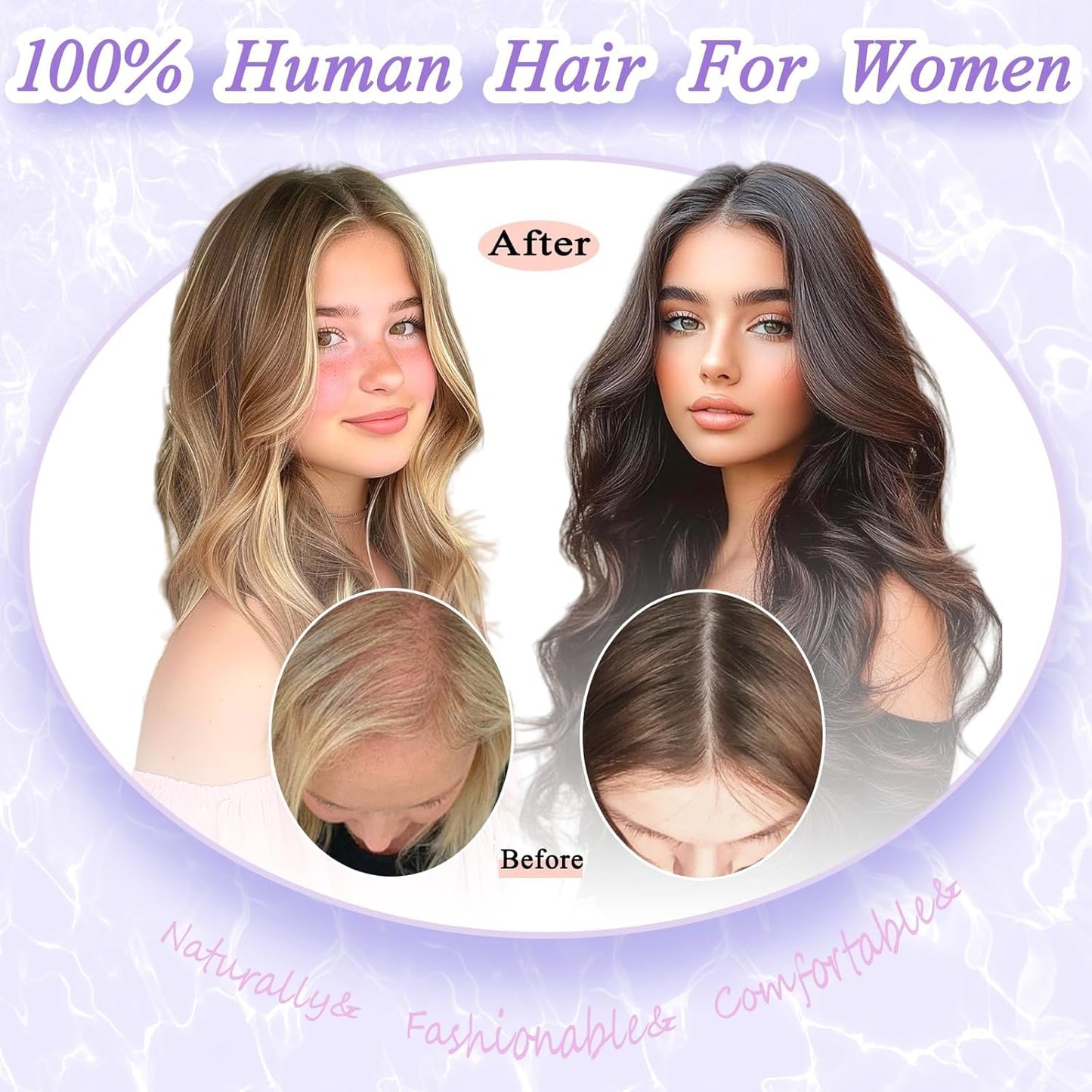 LEDIZE Hair Toppers for Women Real Human Hair, 360° Cover Middle Part Human Hair Toppers for Women with Thinning Realistic Scalp Line Upgrade Basement Toppers Hair Pieces Medium Brown, Side Bangs