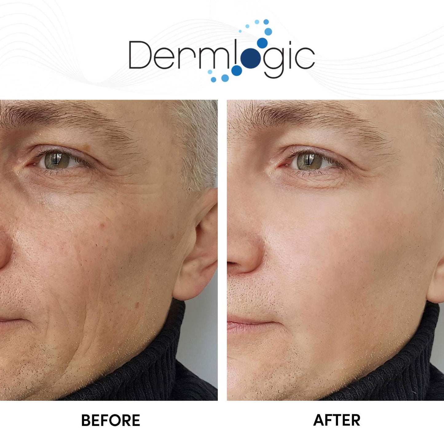 Glycolic Cream 15% - Natural Anti-Aging Exfoliator with A.H.A & Green Tea | Smooth Fine Lines & Dull Skin